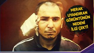 Onu kulağı kesik halde gören herkes aynı soruyu sordu! Teröristin merak uyandıran görüntüsü: Hem utanç verici hem aşağılayıcı