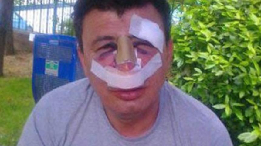 Öğretmene feci dayak!