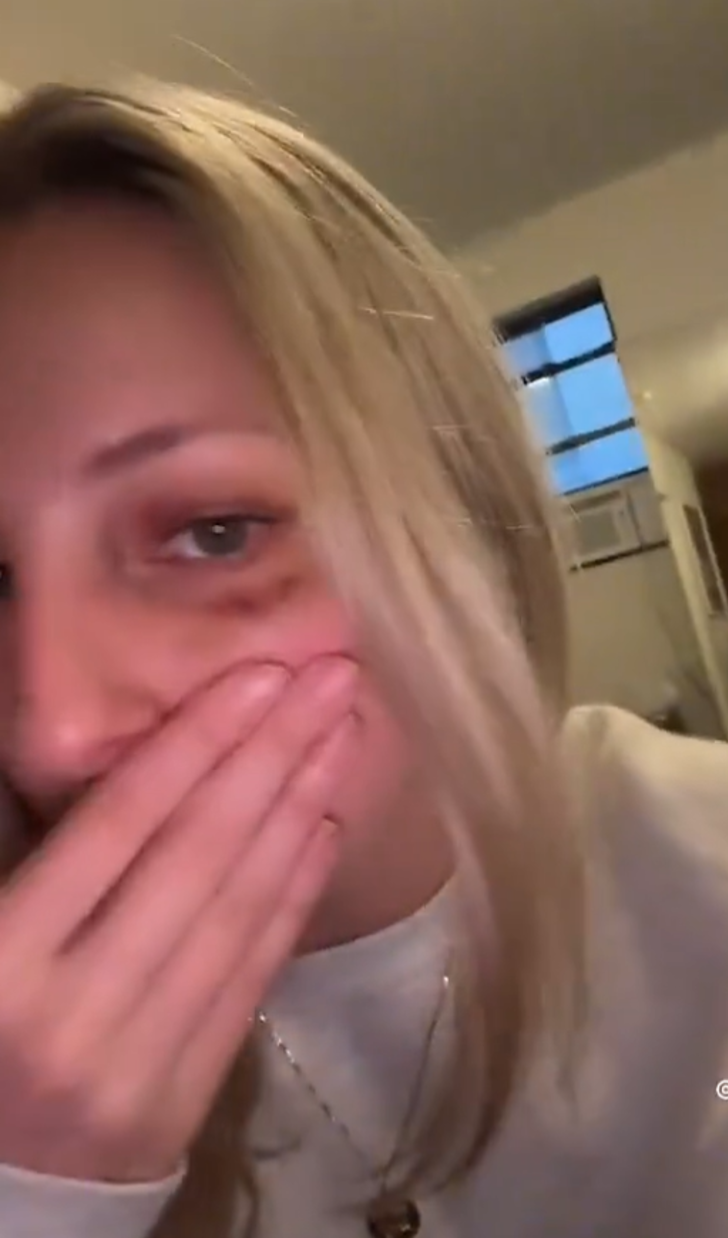 Dört farklı kadın aynı saldırı! Sokakta yürüdükleri sırada tanımadıkları bir adam tarafından yumruklandılar... O anları TikToktan paylaşınca gündem yarattılar G4