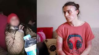 Mutfakta 'elti' dehşeti: Çay ziyaretine gelen misafir arkasından bıçaklayıp kaynar su döktü! Rapor geldi, ceza almadı