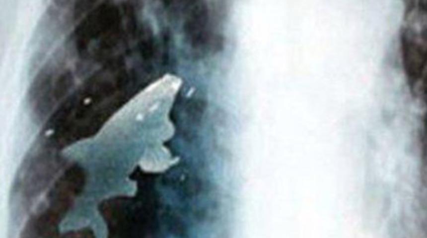 Doktorları şoke eden olay