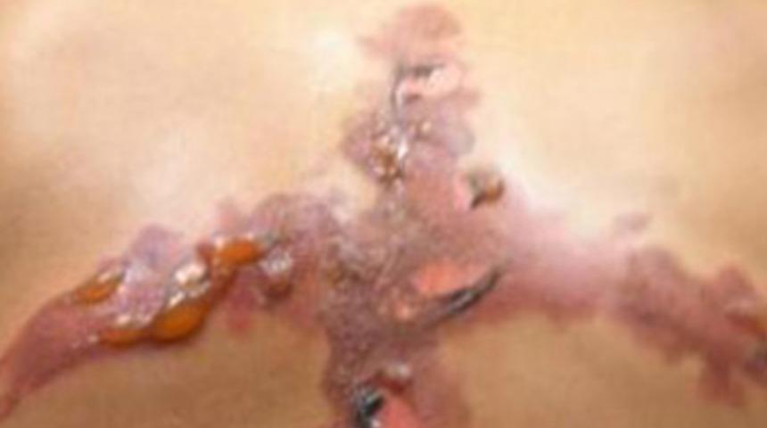 'Tuz-buz işkencesi'