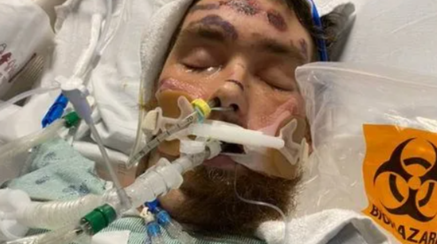 Kıl dönmesi komaya soktu! Yaşama şansı sadece %4 denildi... Doktorlar bile 'mucize vaka' olarak isimlendirdi