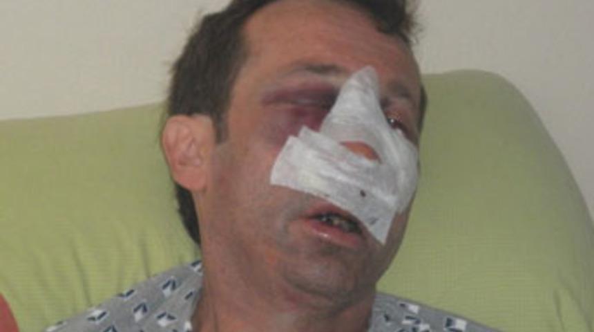 &Ouml;ğretmene &ouml;ld&uuml;resiye dayak