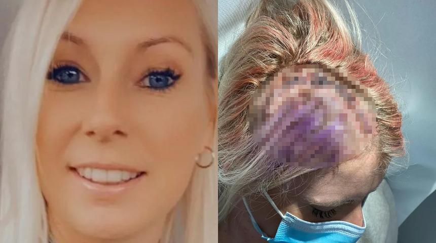 Şiddetli baş ağrıları ve dejavu yaşayan kadın soluğu hastanede aldı! Hayatının şokunu yaşadı