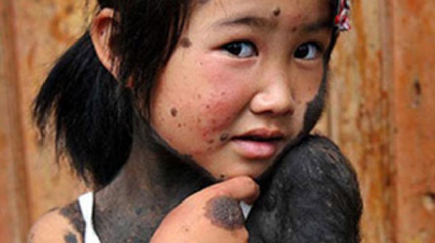 Kurt kızın y&uuml;rek burkan dramı!