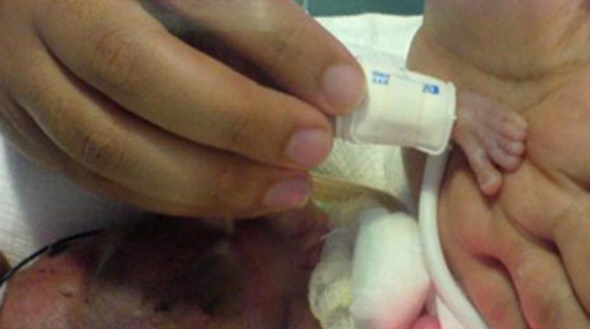 Tam 336 gram doğdu!