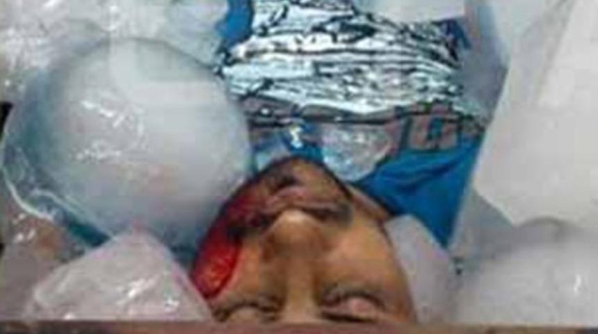 Dehşetin fotoğrafı