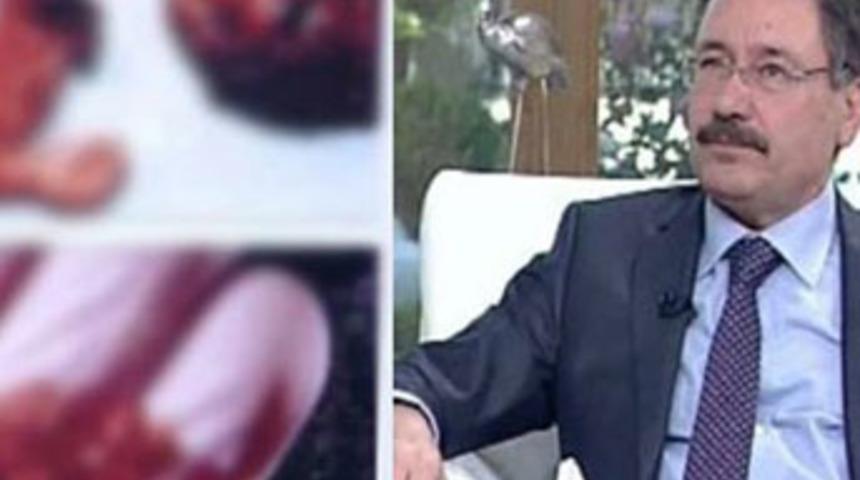 Canlı yayında cenin fotoğraflarını g&ouml;sterdi