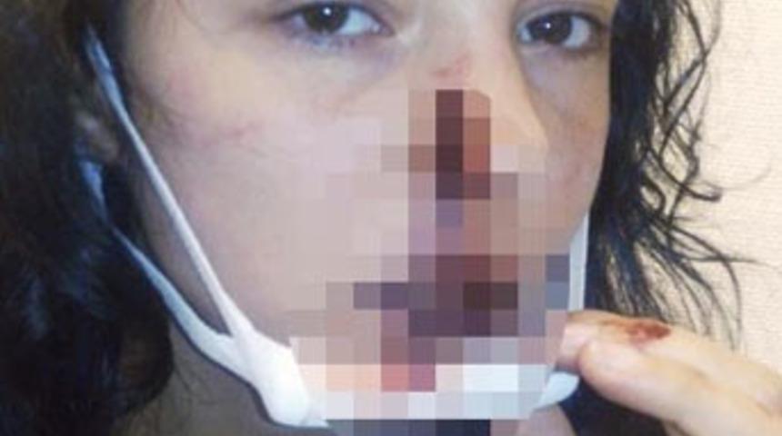 K&ouml;pek kavgası mı ırk&ccedil;ı saldırı mı