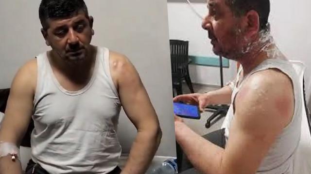 Hatay'da adayın yüzüne asit attılar! Seçime doğru çirkin saldırı: Genel başkan da devreye girdi