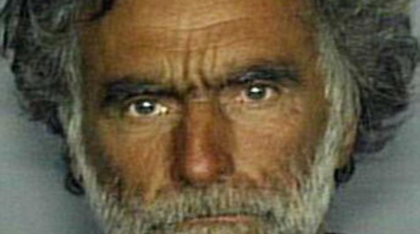 Y&uuml;z&uuml; yenen adamın kimliği a&ccedil;ıklandı!