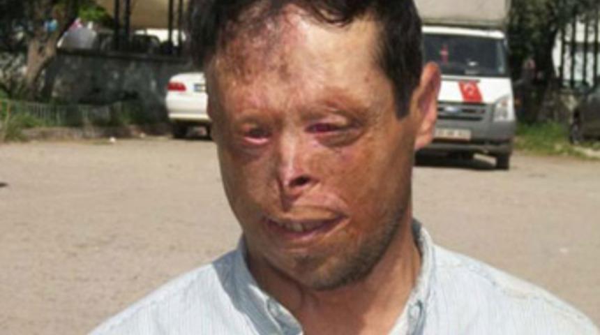 "Para olmadığından oğlumun yanına gidemedik"