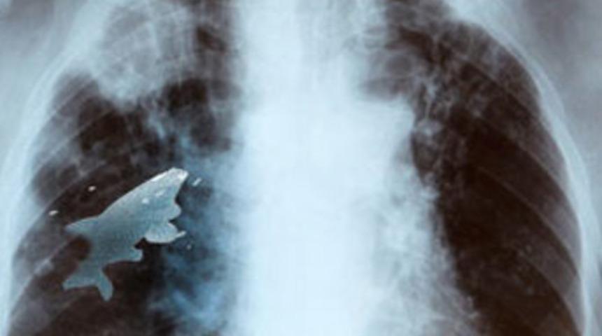 Ciğerinden canlı balık çıktı!