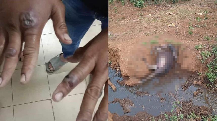 Korkutan şarbon salgını: Vaka sayısı 65’e yükseldi! Komşu ülke alarma geçti