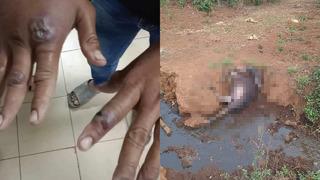 Korkutan şarbon salgını: Vaka sayısı 65’e yükseldi! Komşu ülke alarma geçti