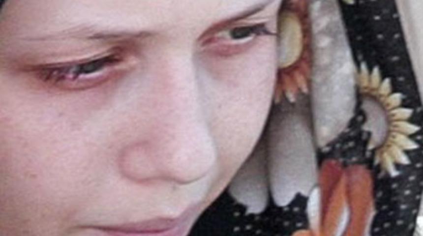 Özlem'in inanılmaz acıları