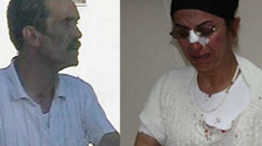 Eski eşe sokak ortasında dayak!