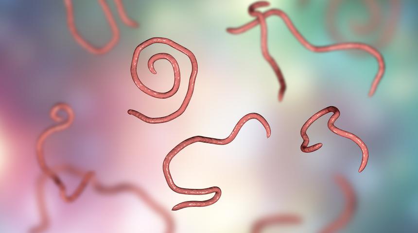 Kıl kurdu nedir, 3 saatte kıl kurdu nasıl dökülür? Kıl kurdu belirtileri ve tedavisi