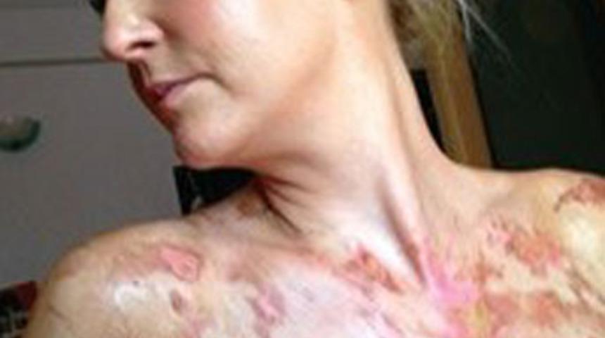 Garsonun şovu İngiliz aileyi yaktı