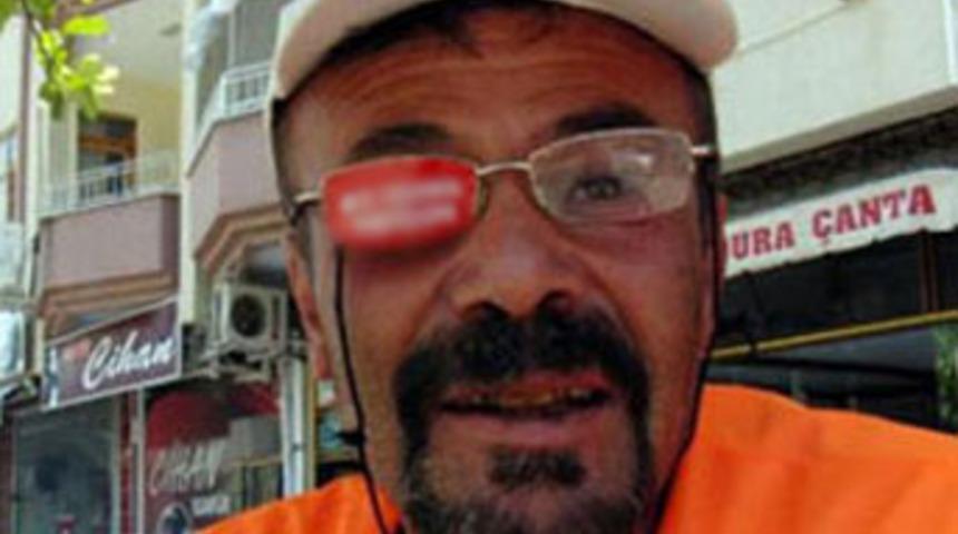 Sağ g&ouml;z&uuml;n&uuml; kiraladı