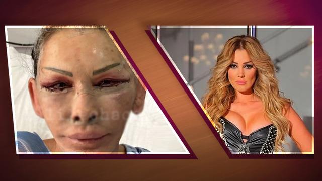 Petek Dinçöz’ün annesi Esra Süay Toğuş yüz gençleştirme ameliyatı oldu! 