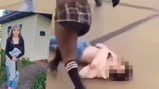 Lisedeki kız kavgası sosyal medyada gündem olmuştu! Şiddet sonrasında hastanelik olan genç kızın bilişsel bozukluk yaşadığı ifade edildi