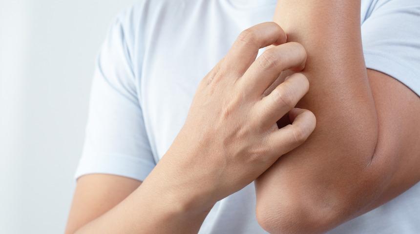 Kanser kaşıntısı nedir, kanser kaşıntısı nasıl olur?