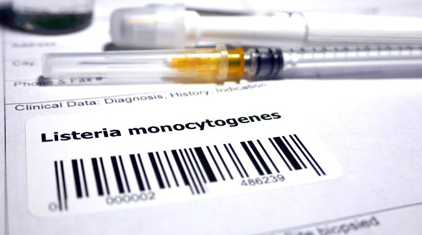 Listeria hastalığı nedir, insana nasıl ve nereden bulaşır? Listeria belirtileri ve tedavisi