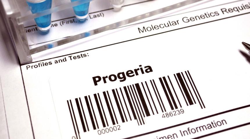 Progeria (erken yaşlanma hastalığı) nedir, neden olur? Progeria hastalığının tedavisi var mı?