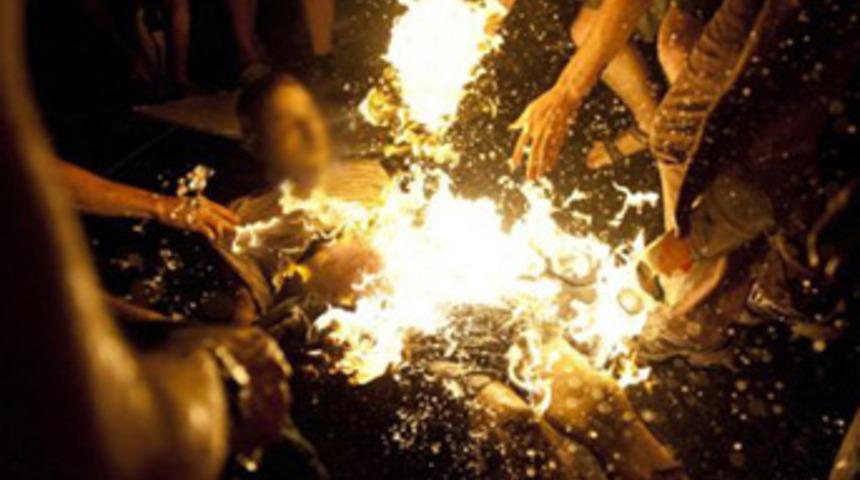 Kendini ateşe verdi!