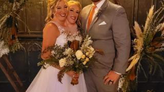 Düğün görüntüleri çok konuşuldu! İkiz kardeşler Abby ve Brittany Hensel'in yatak odasındaki sözleri  sosyal medyada şaşkınlık yarattı