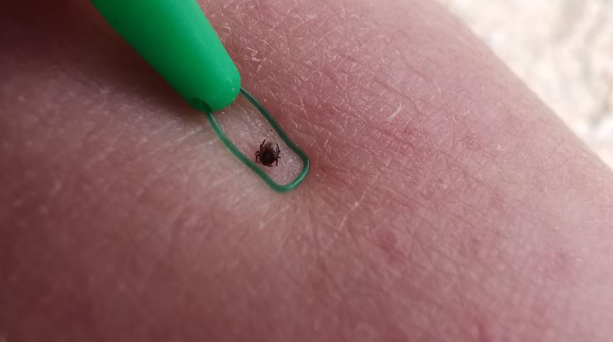 Lyme hastalığı nedir, geçici midir? Lyme hastalığı belirtileri ve tedavisi