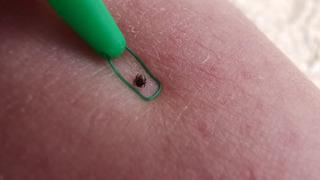 Lyme hastalığı nedir, geçici midir? Lyme hastalığı belirtileri ve tedavisi