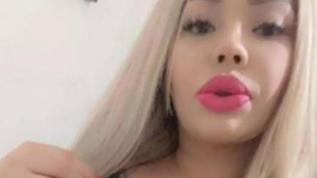 'Doktorum' diyen tıp öğrencisinden korkunç operasyon! Başarısız yağ aldırma işleminde kadını öldürdü ve cesedini masada bırakıp kaçtı