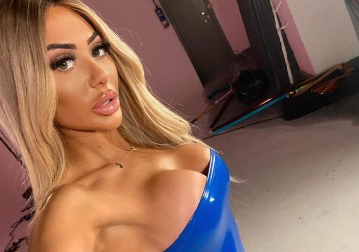 Chloe Ferry, Türkiye'de ameliyat oldu! Yeni halini paylaştı: Vücuduna yakışmış" 18660198-728xauto