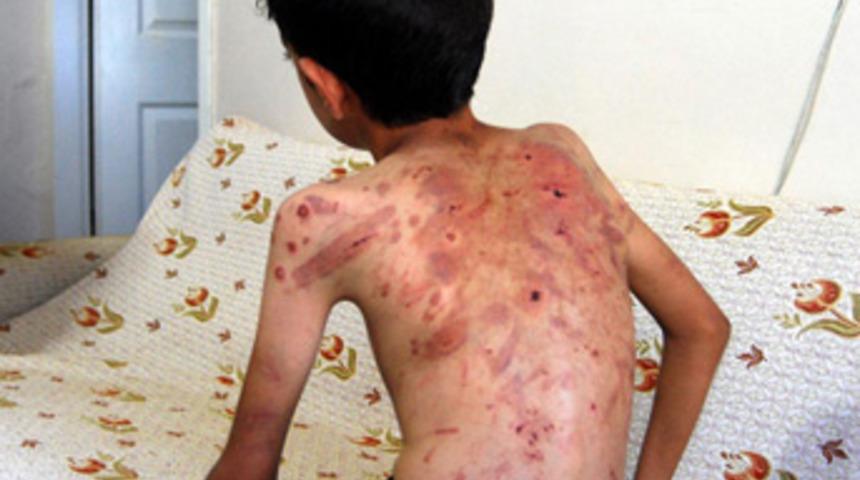 Bu işkenceyi çocuklar yapmış!