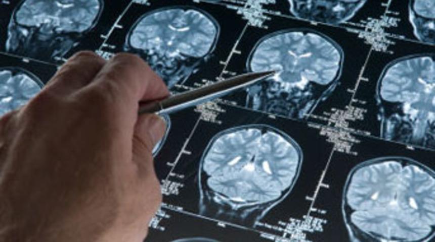 Akrep, beyin tümörünün ilacı olabilir mi?