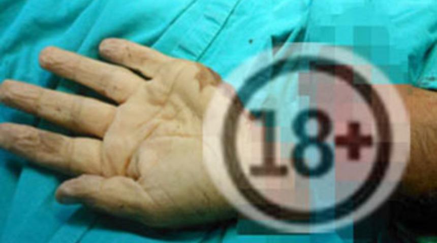 Kopan elini bırakıp kaçtı!