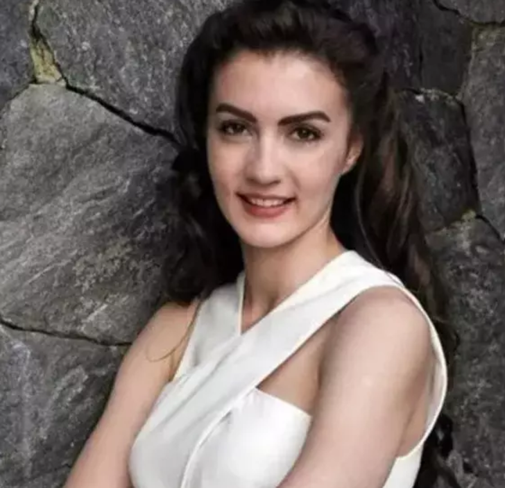 Herkes onu doğal güzel sanıyordu... Ruhun Duymaz'ın Ece'si Burcu Özberk'in estetiksiz hali sosyal medyayı salladı G3