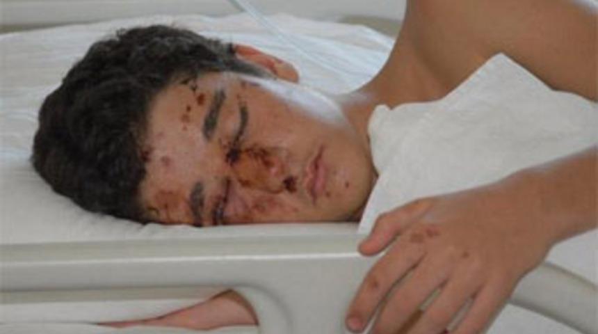 Yaralı çocuğa 'işkence'