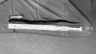 Herkesi şaşkına çeviren vaka! Cerrahlar adamın midesinden 30 cm uzunluğunda canlı yılan balığı çıkarttı