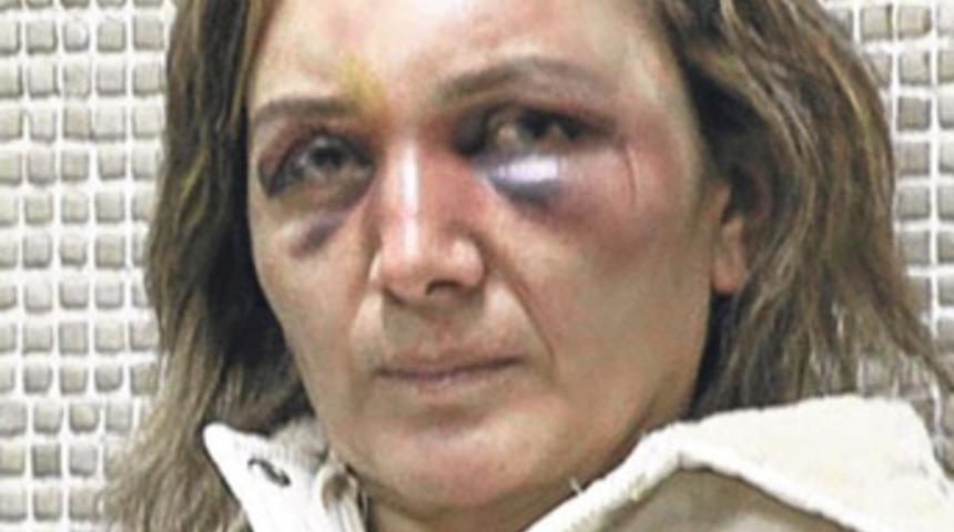 Dayak&ccedil;ı eşe elektronik kelep&ccedil;e!