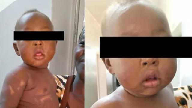 Cani anne yenidoğan bebeğini diri diri gömüp öldürmeye çalıştı! Mucizevi bir şekilde hayatta kalmayı başardı