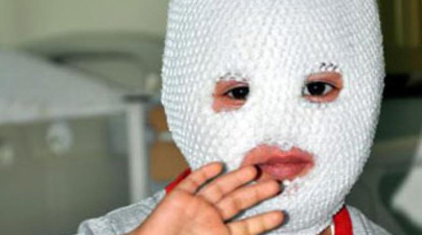 S&uuml;t dolu tencere y&uuml;z&uuml;n&uuml; yaktı!