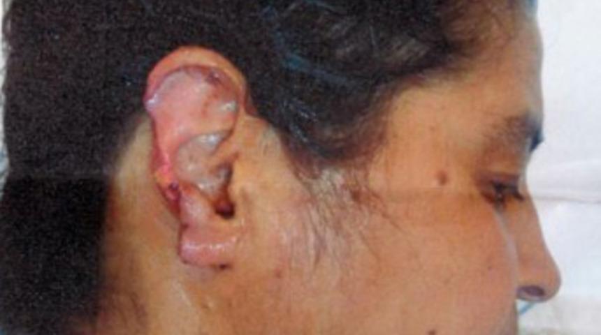 Kocası kulağını kopardı!