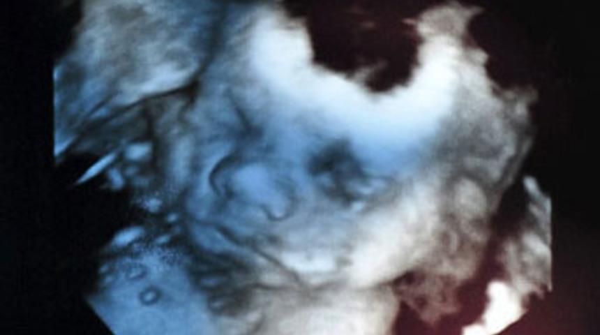 Anne karnında ş&ouml;hret oldu