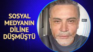 Cenk Eren yüzünü gerdirip Ben Türkiye'nin George Clooney'siyim demişti! Son halini paylaştı
