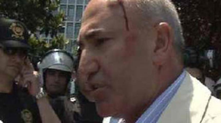 CHP'li vekilin kafası yarıldı!