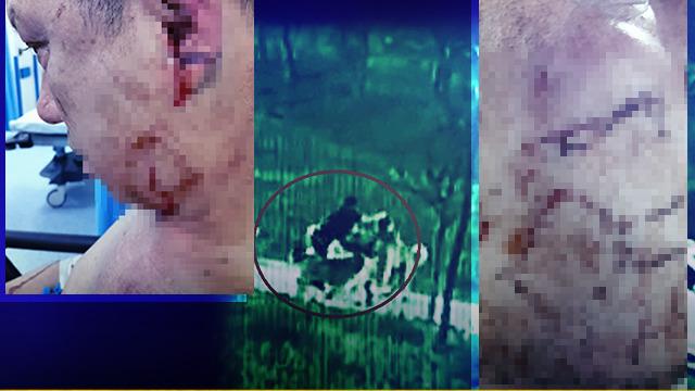 Bursa'da başıboş köpek dehşeti: Oğlu için kendini feda etti! 1,5 ay pipetle beslenecek... Korku dolu anlar kamerada